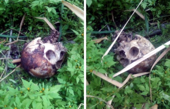 У Сторожинці поблизу багатоповерхівки школяр знайшов людський череп