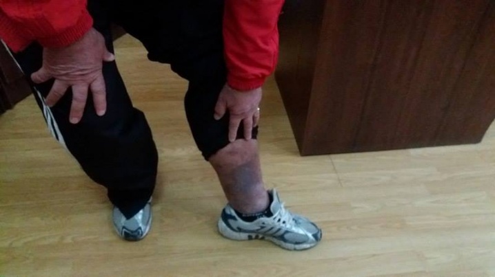 У чернівецькій спортшколі планують скаржитись у прокуратуру на дії поліції У чернівецькій спортшколі планують скаржитись у прокуратуру на дії поліції