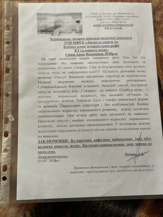Маленькій буковинці Анні Свищ потрібна допомога на лікування
