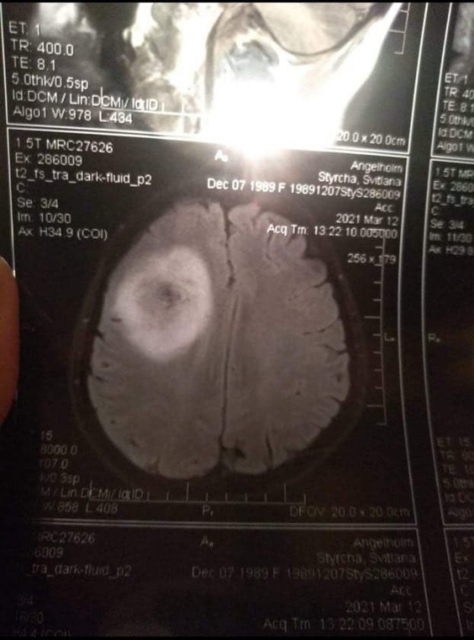 Молодій матері зі Сторожинця потрібна допомога у боротьбі із важкою хворобою