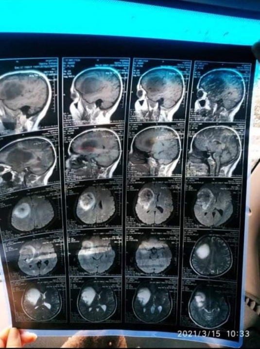 Молодій матері зі Сторожинця потрібна допомога у боротьбі із важкою хворобою