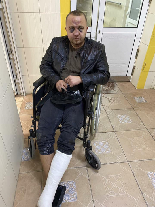 У Чернівцях сталася бійка, в якій жорстоко побили чоловіка У Чернівцях сталася бійка, в якій жорстоко побили чоловіка