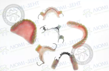 Съемные зубные протезы в стоматологической клинике Люми-Дент (Киев)