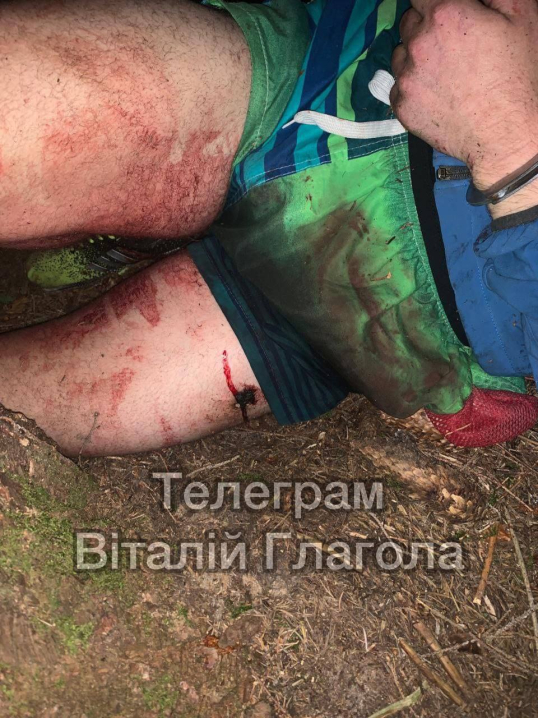 Напад на прикордонника в Чернівецькій області: один з хлопців помер (фото 18+)