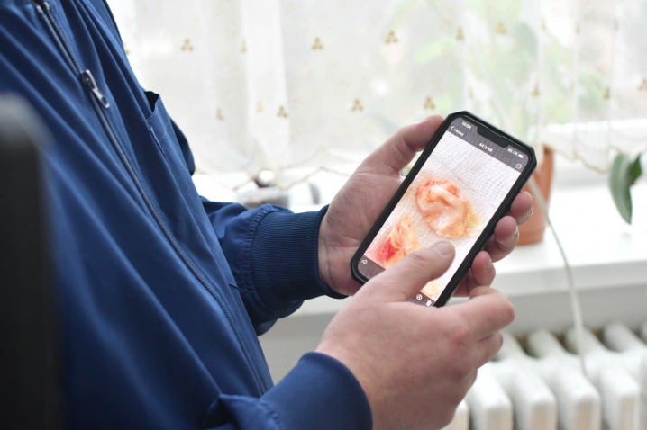 Зупиняли серця: хірурги у Чернівцях виконали дві складні операції на власному обладнанні Зупиняли серця: хірурги у Чернівцях виконали дві складні операції на власному обладнанні