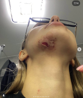 У Чернівцях виродок місяцями переслідує жінку з дитиною. Ніхто не може її захистити