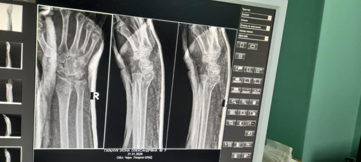 Впала двічі на одній вулиці: чернівчанка заплатила за операцію 7 місячних пенсій