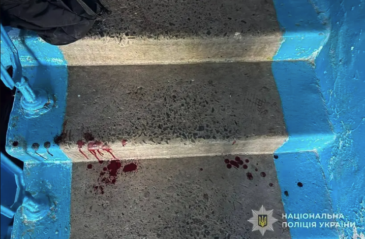 Уламок застряг в голові: у Тернополі школярка вдарила однокласницю ножем