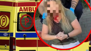 У Польщі в місті Гдиня палицею розбили голову українській жінці