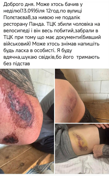 У Чернівцях бус ТЦК збив колишнього військового на велосипеді, – нардеп